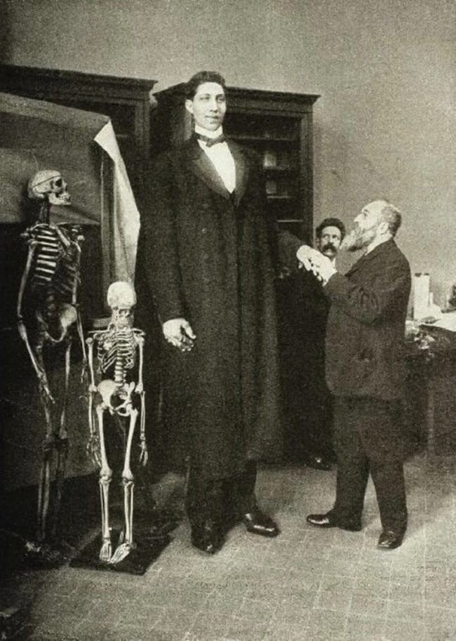 Самый высокий человек, которого когда-либо видел свет, — Федор Махнов. Его рост 285 см при весе около 182 кг. 1900-е.