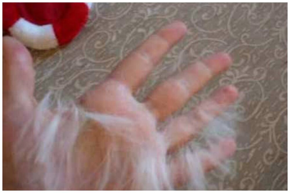 линька кожи