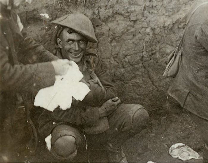 9. Безумный взгляд: контуженный солдат во время Первой мировой войны, 1916 год. Контузия приводит к потере рассудка, вплоть до того, что человек не может спать, ходить или говорить. 