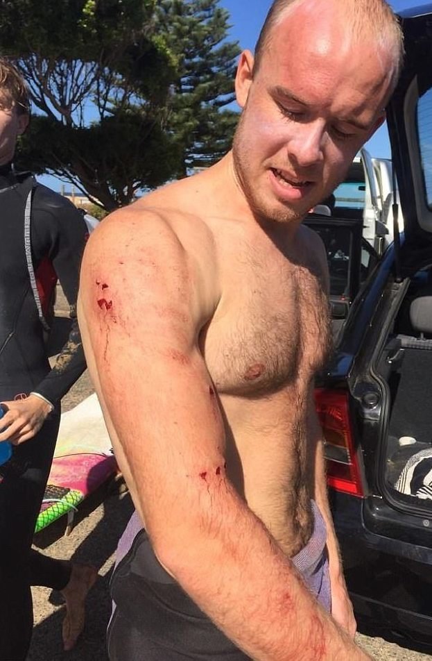 Британский серфер отбился кулаками от гигантской акулы