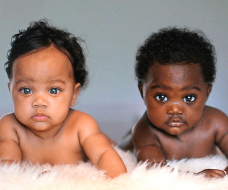 Двойняшки с разным цветом кожи покорили Инстаграм