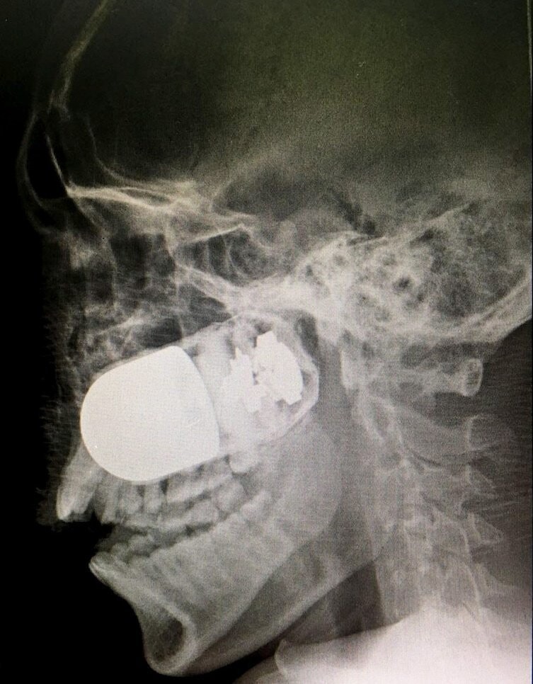 Даже врачи не сразу поверили в то, что увидели на этих рентгеновских снимках!