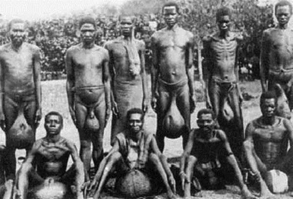 Племя Бубал — гигантские гениталии