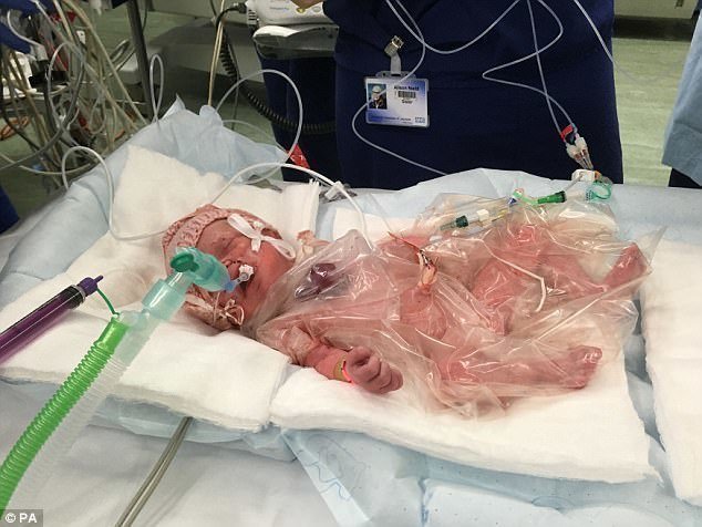Сейчас малышка находится на искусственной вентиляции лёгких, и врачи уверены в том, что она успешно восстановится