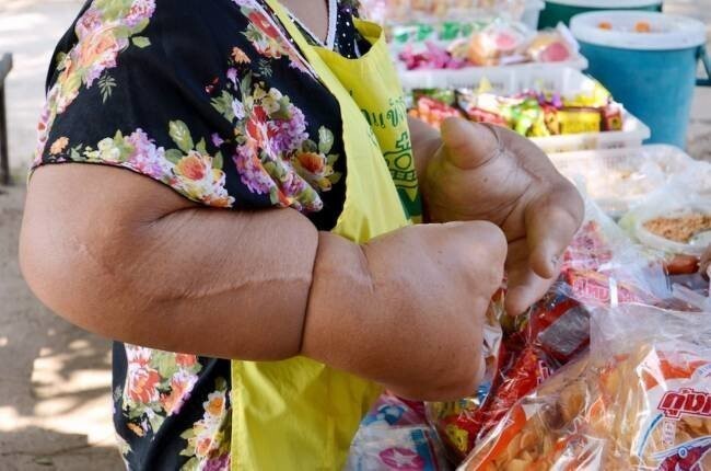 В Таиланде живет женщина с самыми большими руками в мире