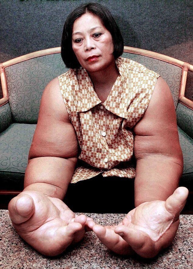 В Таиланде живет женщина с самыми большими руками в мире