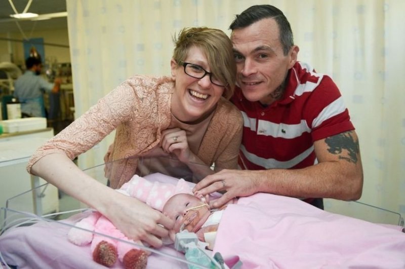 В Британии врачи спасли девочку, родившуюся с сердцем вне грудной клетки