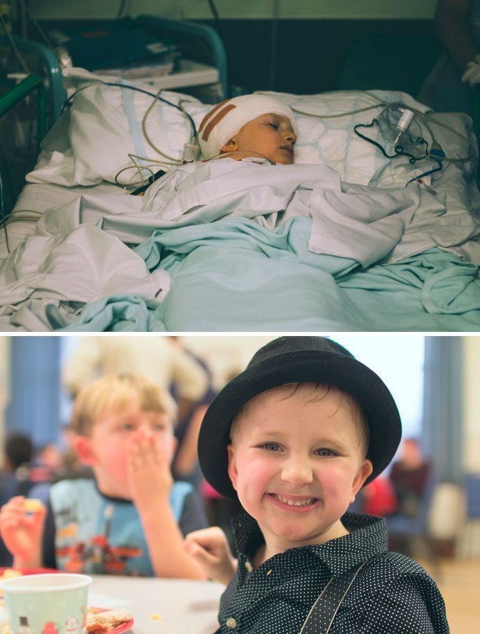 9. 14 раундов химиотерапии, 30 раундов лучевой терапии, 4 операции... Но мальчика спасли!