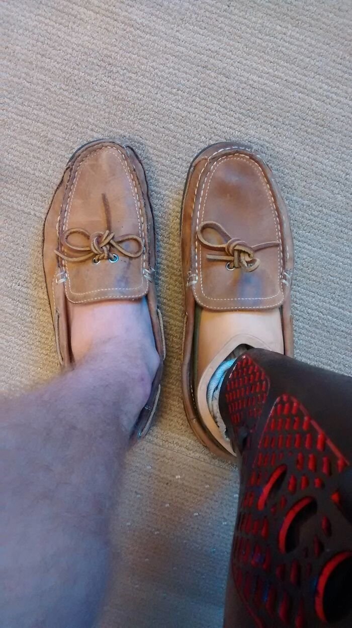 "Вот как выглядит обувь на моей ноге и на протезе спустя 1 год носки"
