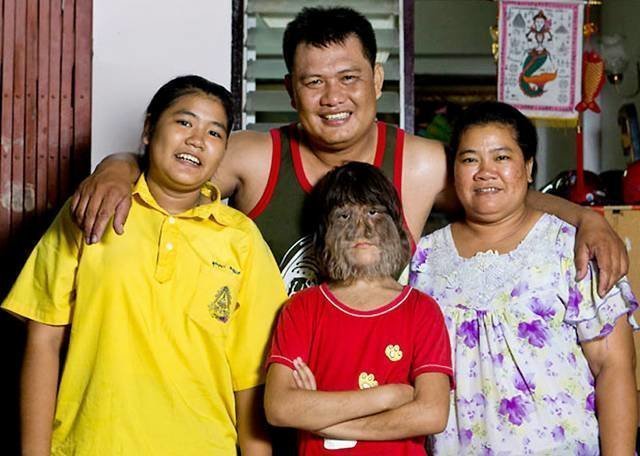 Самая волосатая девушка в мире из таиланда вышла замуж и теперь постоянно бреется