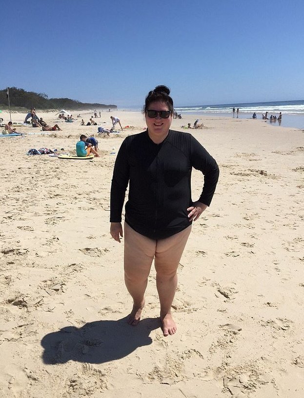 После неудачного фото австралийке пришлось заново учиться любить свое тело