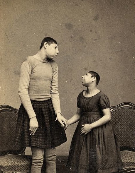 3. Хомио и Лола, дикие дети Австралии, 1885