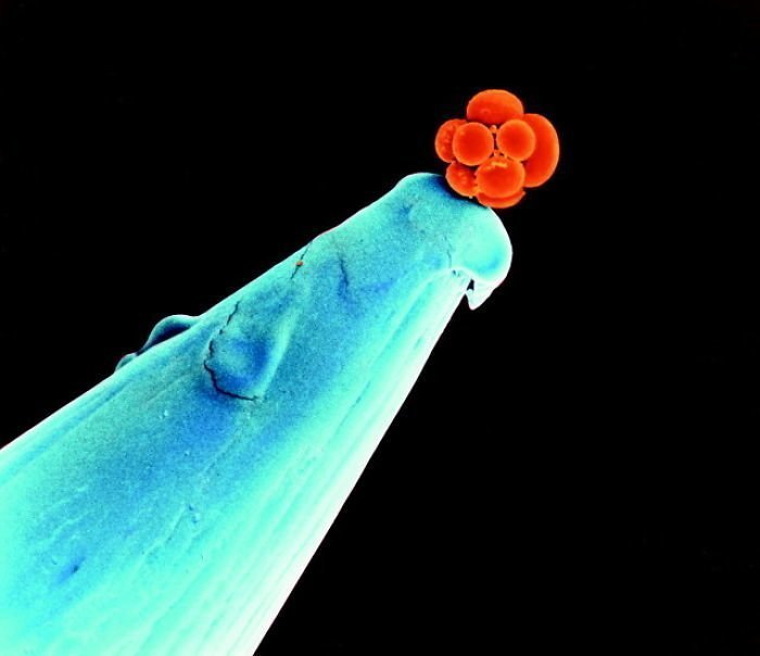 Человеческий эмбрион на кончике иголки