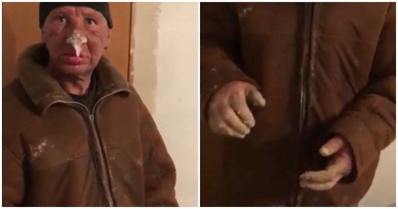 Житель Казахстана получил жуткое обморожения после недели, проведенной на улице