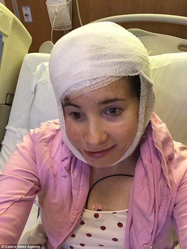 Недавно Иванка пережила сложнейшую черепно-лицевую операцию, которая длилась 13 часов и была проведена всемирно известным специалистом в Чикаго. После этого у девушки появился шанс жить полноценной жизнью.