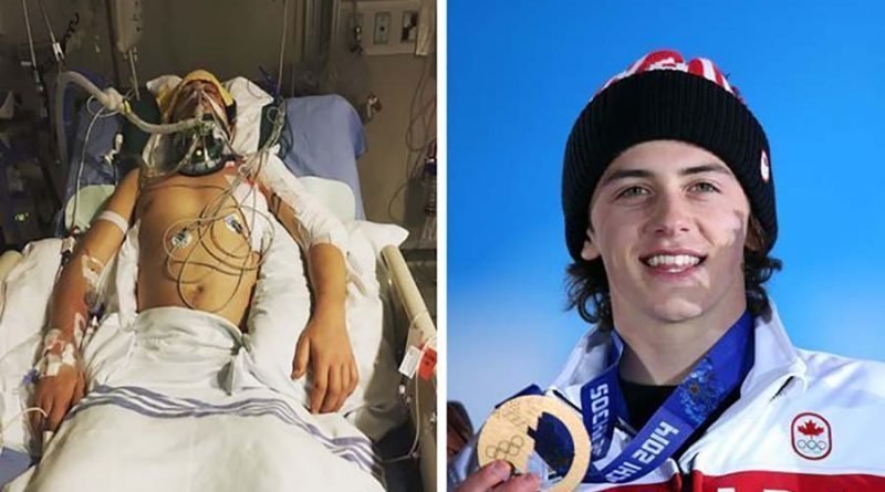 Сноубордист оправился от ужасной аварии, чтобы выиграть олимпийскую медаль