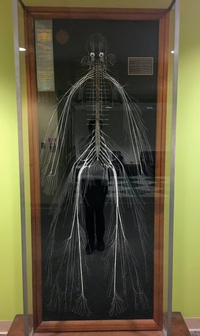 Это первая полная карта нервной системы, извлеченная в 1887 году из тела умершей служанки. Она работала в медицинском колледже Дрексельского университета и завещала свое тело науке. На извлечение ушло несколько сотен часов!