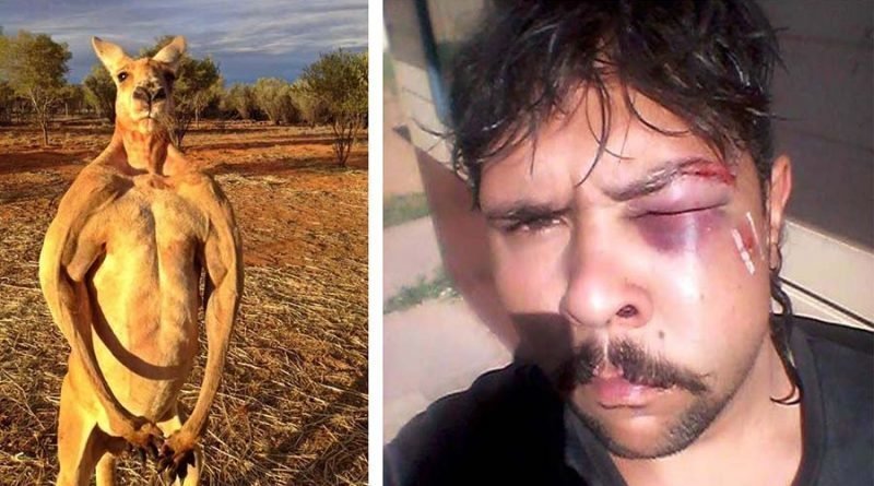 В Австралии кенгуру сломал челюсть 19-летнему охотнику