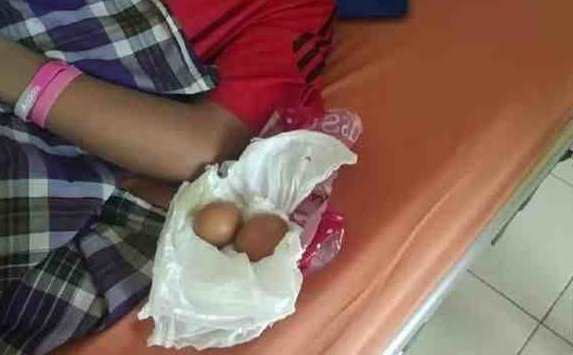 В Индонезии мальчик научился откладывать яйца не хуже птиц