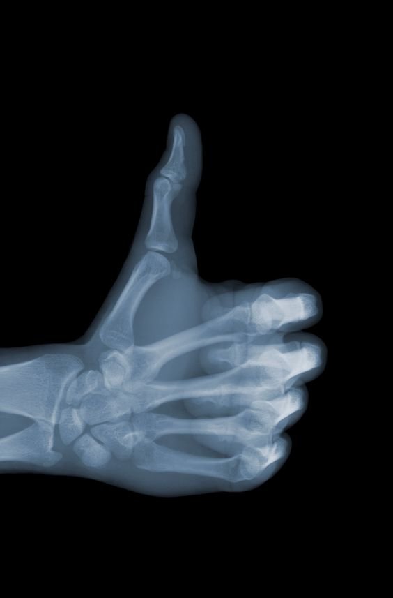Мир в рентгеновских лучах - вид искусства, где видна изнанка бытия