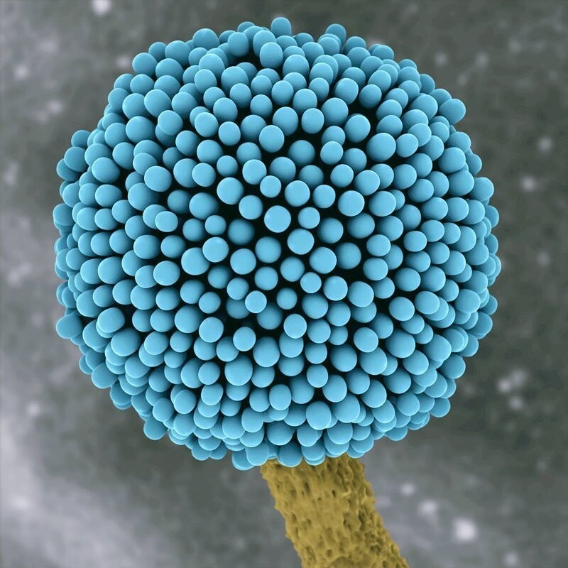Черная плесень (Aspergillus niger) под микроскопом. Опасна для человека