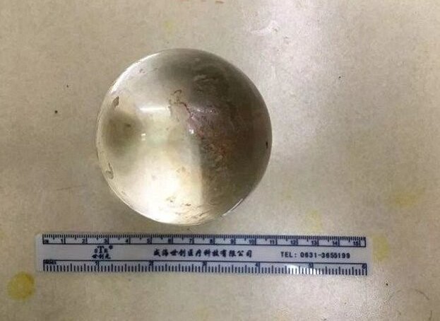 Китайца доставили в больницу с 8-сантиметровым шаром в прямой кишке