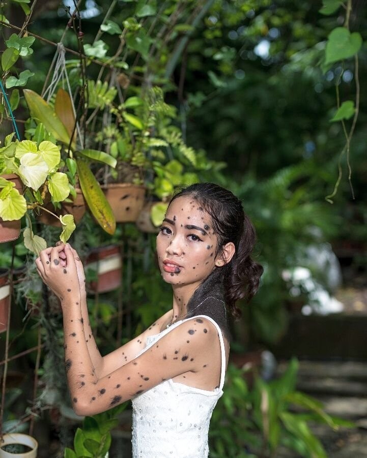 21-летняя малазийка со множеством родинок прославилась благодаря внешности