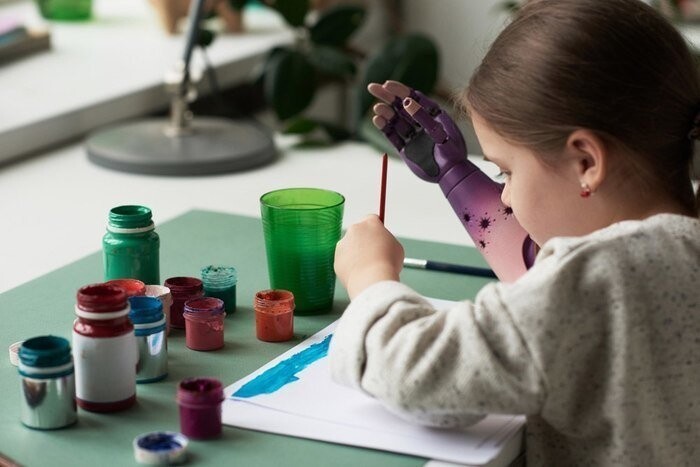 6-летней девочке из Челябинска сделали киберруку, которой она научилась рисовать