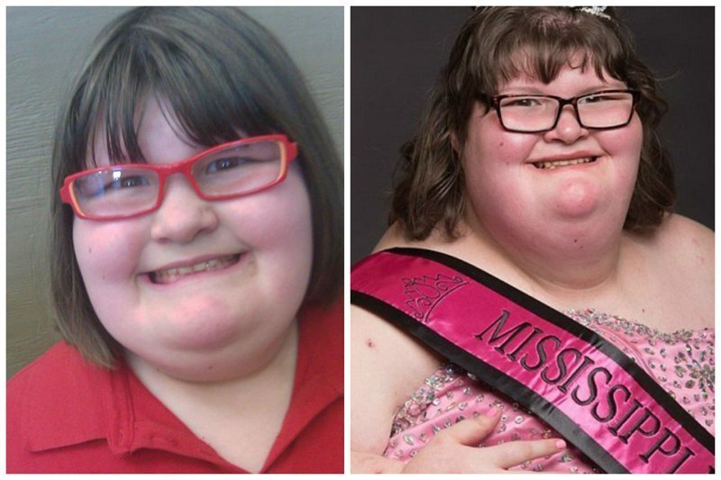 172-килограммовая девушка стала королевой красоты в Миссисипи