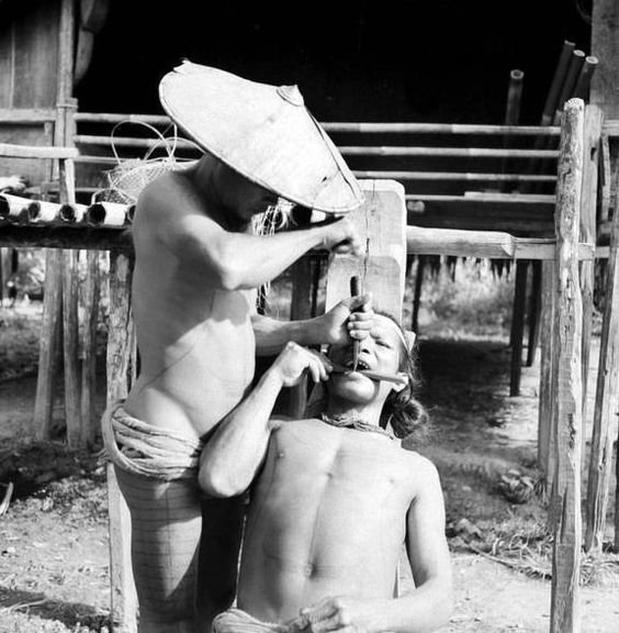 10. А вот удаление зубов в Индонезии, 1938 год