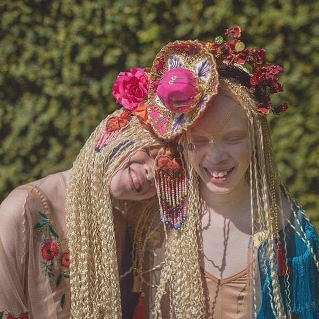 Редкие цветы: близнецы-альбиносы Лара и Мара Бавар, которые покорили модную индустрию