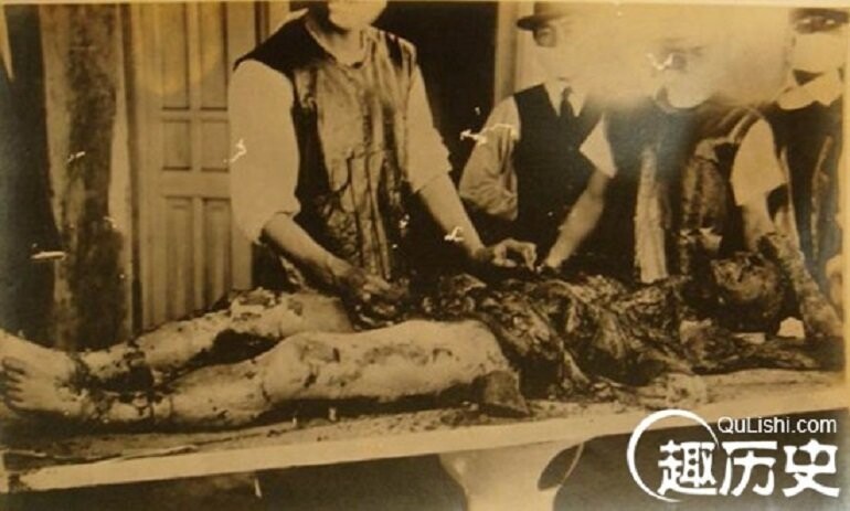 История отряда японских врачей-убийц