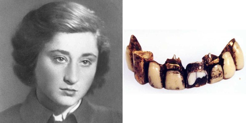 Она хранила зубы Гитлера, чтобы доказать его смерть по фрагменту челюсти