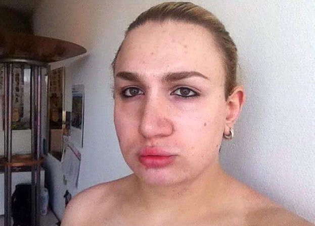 Девушка-трансгендер потратила на пластических хирургов  $150 000