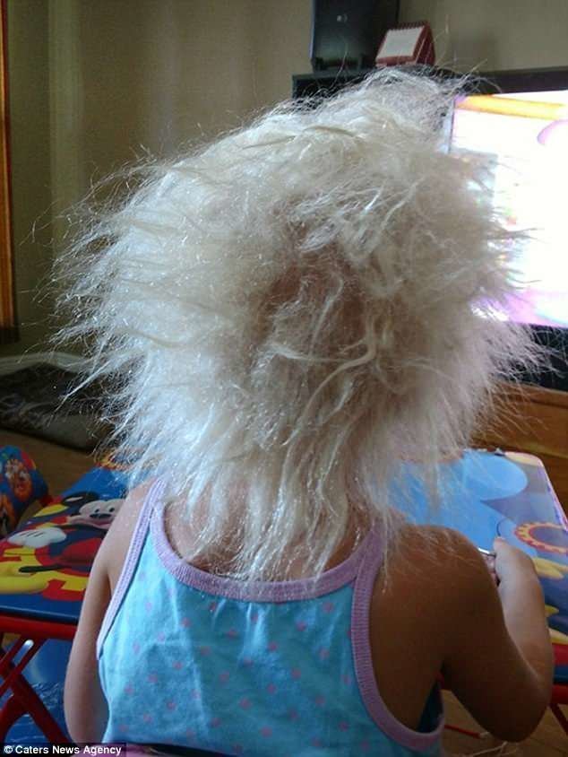 По словам Николь, матери Ивлин, до десяти месяцев девочка была совершенно лысой, волосы начали расти ближе к году
