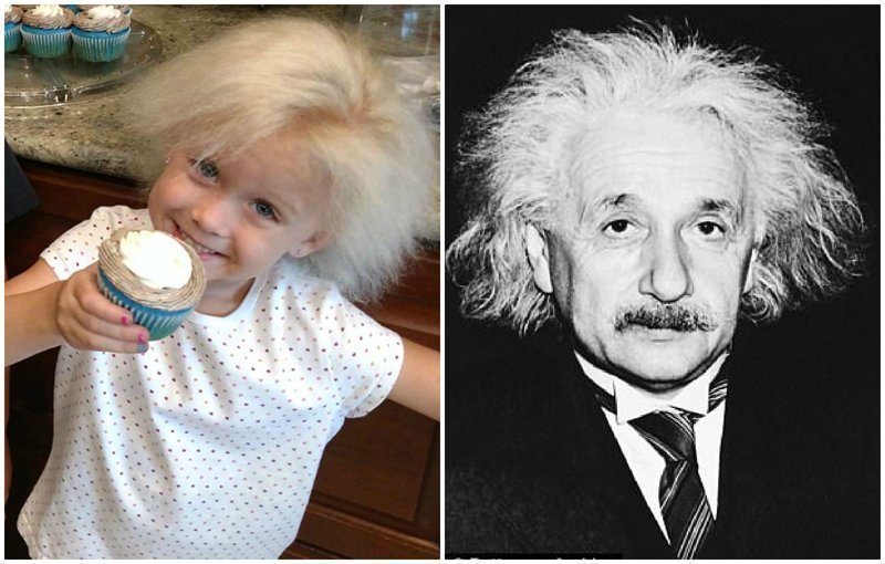 Из-за редкой мутации у 5-летней девочки растут "волосы Эйнштейна"