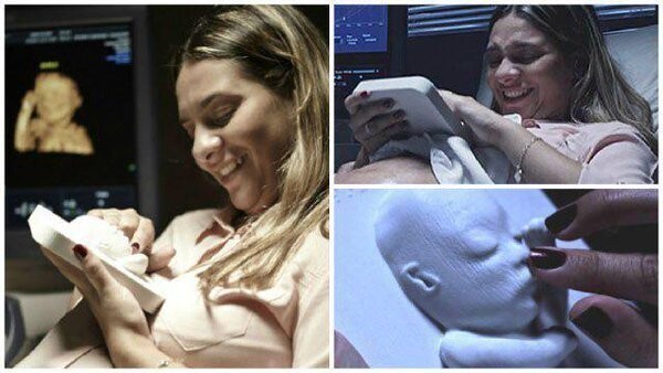 4. Матери могут потрогать 3D-модель ребенка еще до того, как он родился