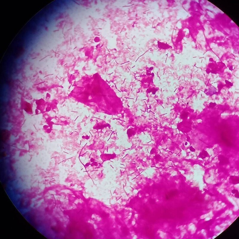 Красота внутри: микробиолог из Уфы показывает в инстаграме вирусы и бактерии, которые живут в нас