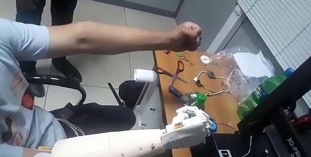 Невероятный момент: мужчина впервые управляет своей бионической рукой силой мысли!
