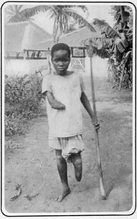 17. Мальчик, изуродованный бельгийскими солдатами в Конго, 1905 год