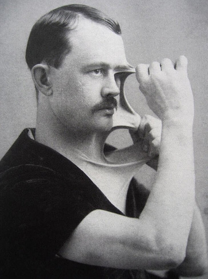 11. Феликс Веррл, человек с удивительно эластичной кожей, начало 1900-х годов.