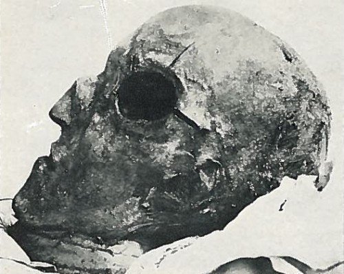 Тайна гибели короля Карла XII. Мумии и скелеты