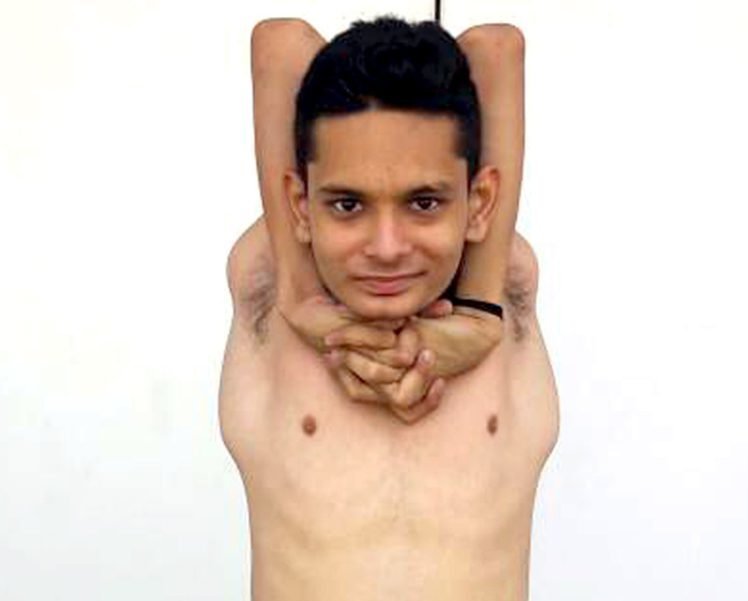 Индийский уникум: юноша научился выворачивать руки и ноги под любым углом