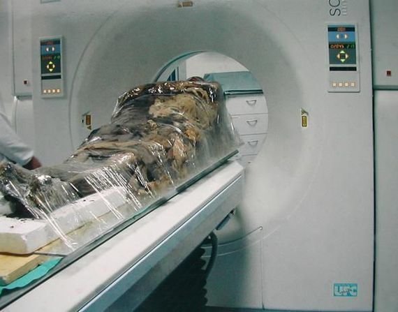 Сначала было проведено КТ-сканирование мумии. 