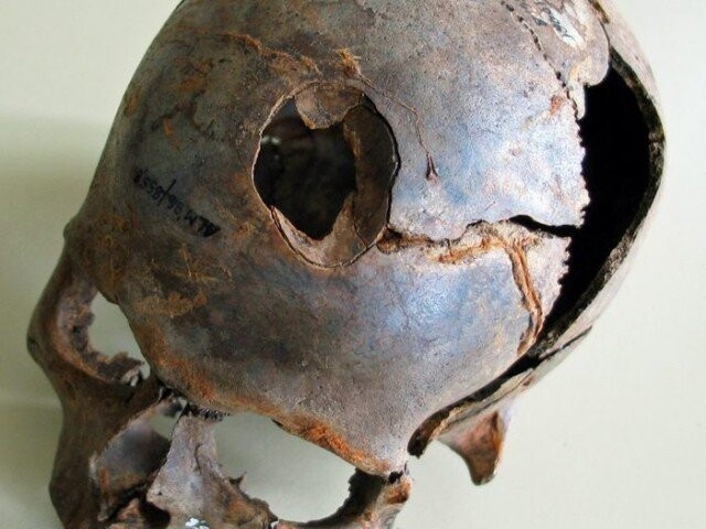 А вот этому обладателю черепа, проломили череп дубиной, напоминающей клюшку. Остатки таких дубин так же были найдены. 