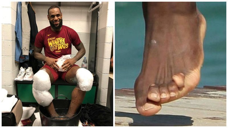 Баскетбол требует жертв: "лотусовые ножки" игроков НБА