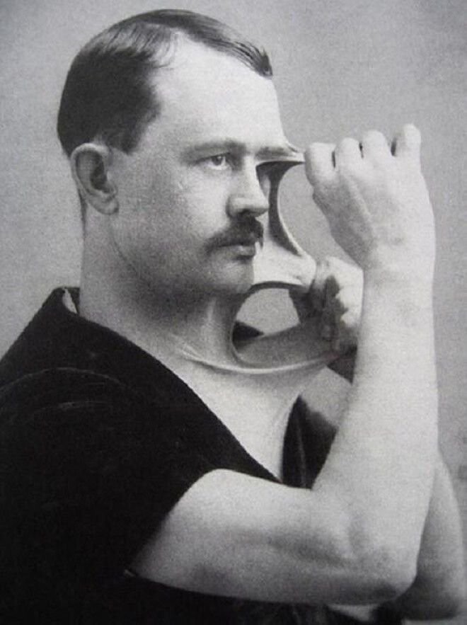 Мужчина с невероятно эластичной кожей, 1900-е.
