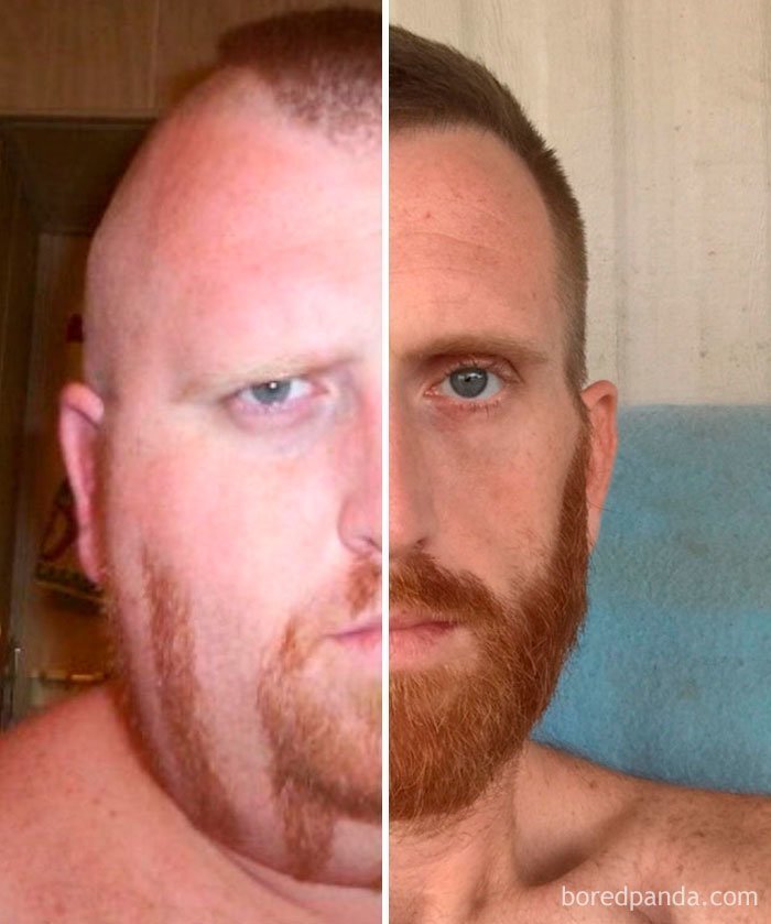 Наглядно: до и после похудения на 100 кг