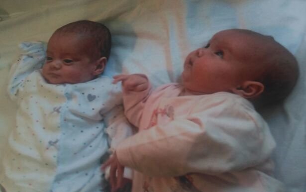Уникальные двойняшки родились с разницей в 87 дней