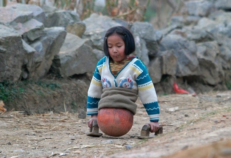 Девочка с баскетбольным мячом вместо ног стала известной спортсменкой